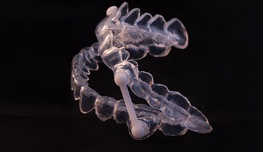 Model of an oral appliance for sleep apnea.