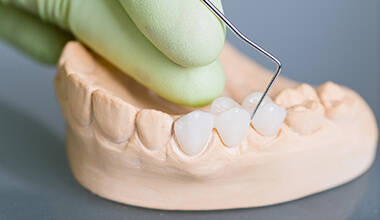 Dentist placing crown and bridge on plaster mock-up