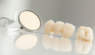 fixed bridge and dental crown with mirror