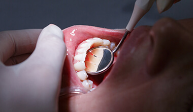 Worthington Periodontal Therapy woman receiving dental exam