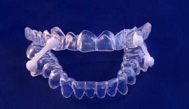 a custom oral appliance for sleep apnea