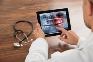 digital x-ray image oral cavity