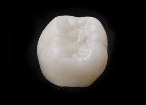 A ceramic dental crown