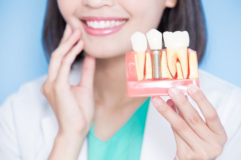 woman holding dental implant model