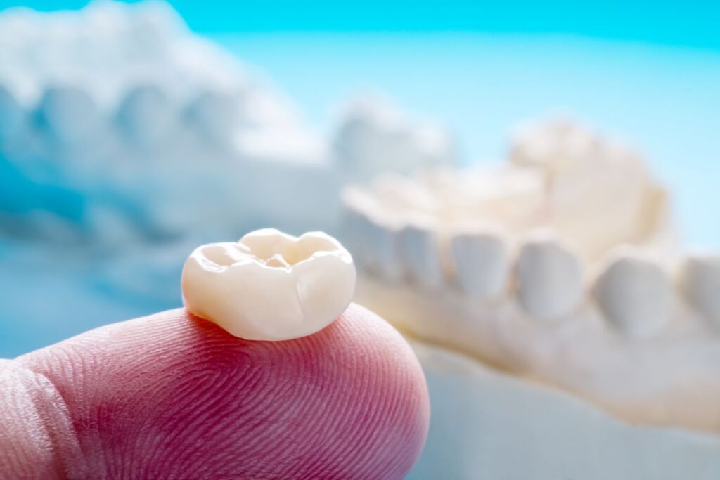 A dental crown on a fingertip